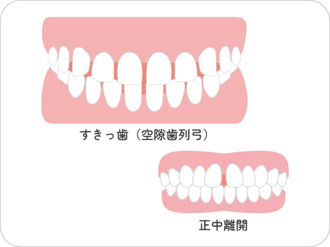 とよす矯正歯科